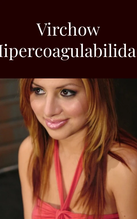 Triada de Virchow Hipercoagulabilidad del Deseo